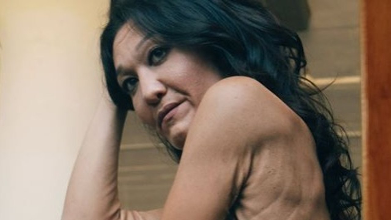 Syndrome D'Ehlers Danlos : Sarah Geurts est une petite fille de 10 ans atteinte de cette maladie extrêmement rare