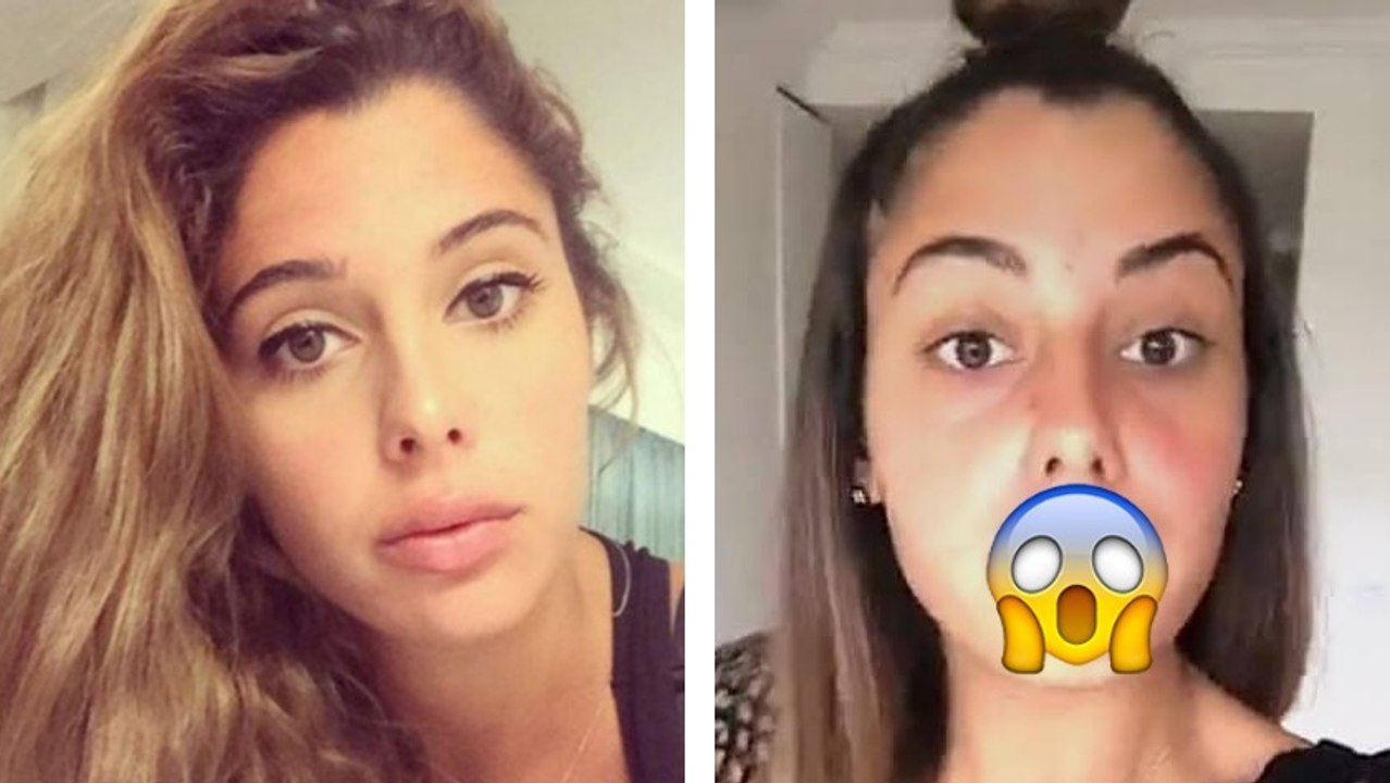 Les vacances des Anges 2 : l'étonnante technique de Coralie Porrovecchio pour avoir des lèvres pulpeuses !