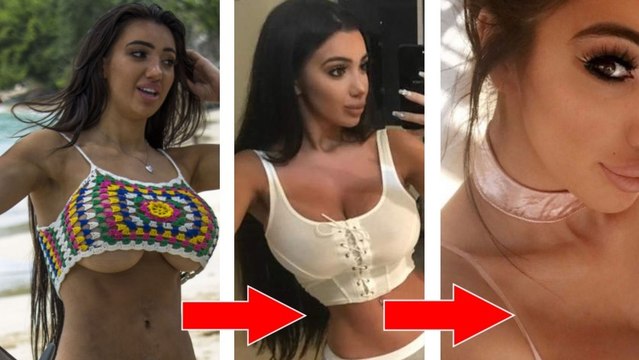 Chloe Khan : elle se fait tellement refaire le nez qu'elle ne peut plus respirer