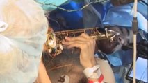 Santé : cet homme joue du saxophone pendant qu'il se fait opérer d'une tumeur