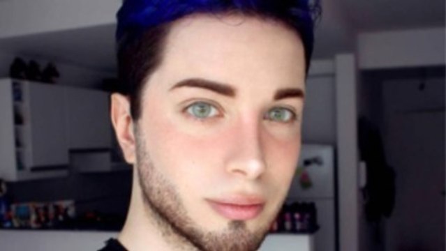 Après avoir dépensé 47 000 $ en chirurgie esthétique, la transformation de Luis Padron en elfe est presque terminée !