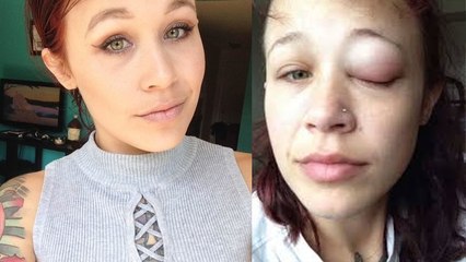 Elle décide de se faire tatouer l’œil, mais la séance vire au drame