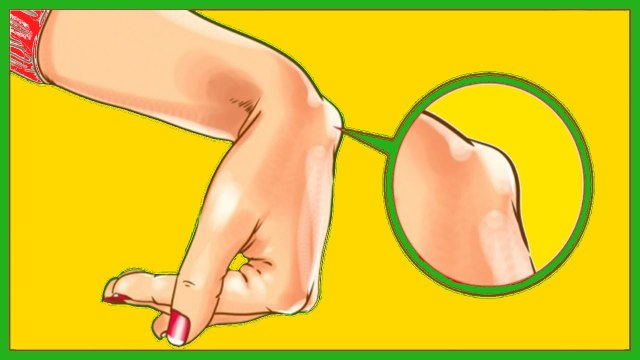 Santé : si vous avez cette bosse sur le poignet, vous devriez peut-être vous inquiéter...
