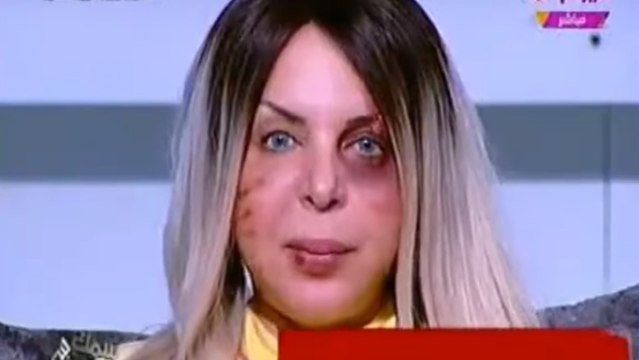Une présentatrice égyptienne apparaît à l'écran le visage tuméfié pour dénoncer les violences conjugales