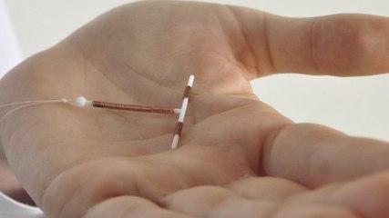 Stérilet : une protection contre le cancer du col de l'utérus