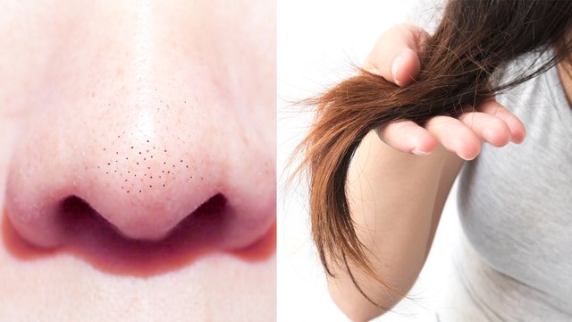 Dites adieu aux points noirs et hydratez vos cheveux avec le même ingrédient