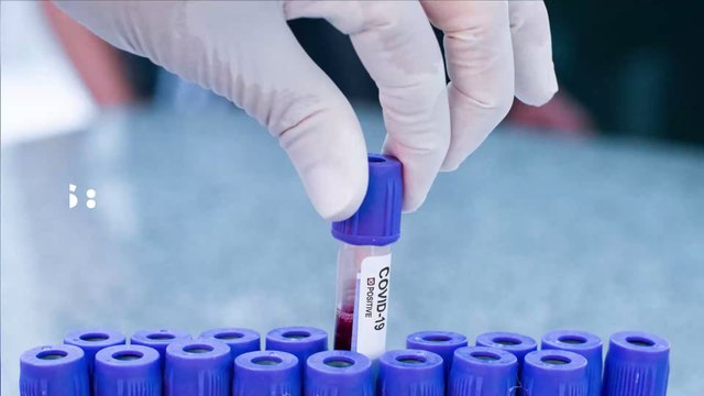 Covid-19 : le premier test à faire soi-même à la maison voit le jour !