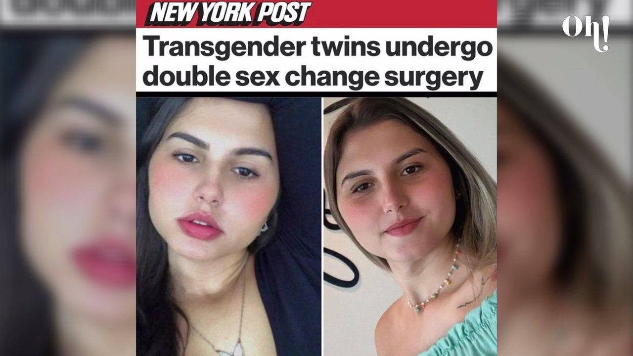 Insolite : ces jumeaux changent de sexe grâce à leur grand-père