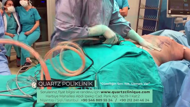 Vaser Liposuction ile Vaser Hi Defination arasındaki fark nedir, nasıl uygulanır_
