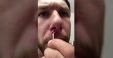 This Man Removed Something Horrendous From His Nose
