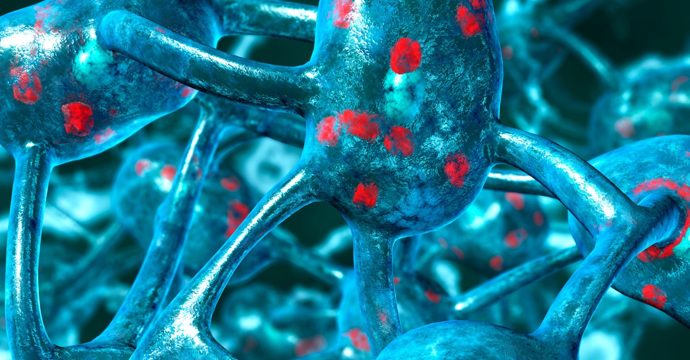 A Public Health Emergency Has Been Declared In New York After An Outbreak Of This Killer Disease