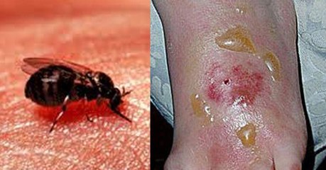 NHS: Swarms Of Dangerous Blandford Flies To Strike The UK