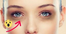 Get Rid Of Dark Circles In 30 Seconds With This Simple Tip