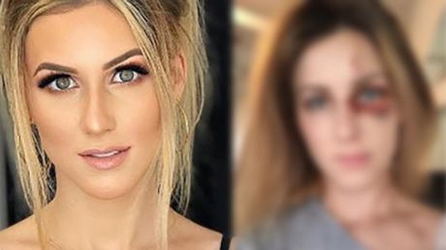 This Influencer Posted A Shocking Photo To Raise Awareness Of Domestic Violence