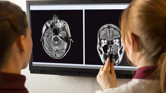 A teenager smelled foul odours for years only to find a strange object stuck in his nose