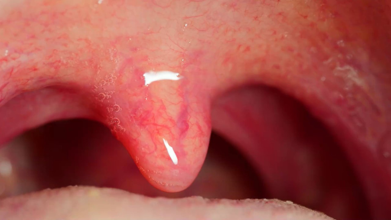 Why do you have a uvula?