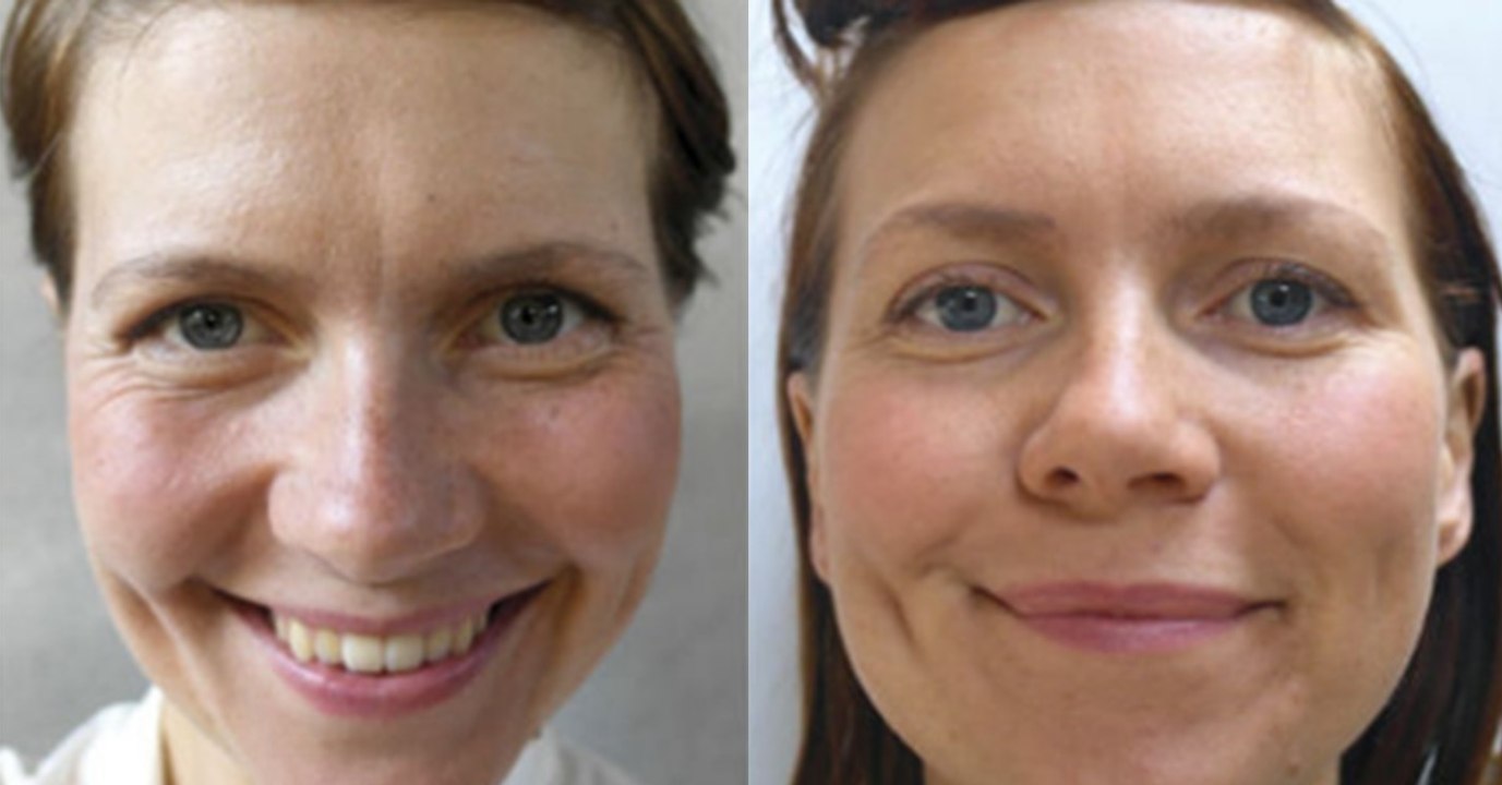 This Woman Got Amazing Results After Drinking 3.5 Litres Of Water A Day For A Month