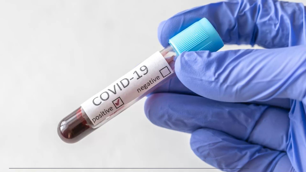 Covid-19: Everything you need to know about the new rule changes