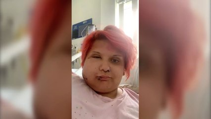 Woman’s face swells to twice the size after brushing against this toxic plant