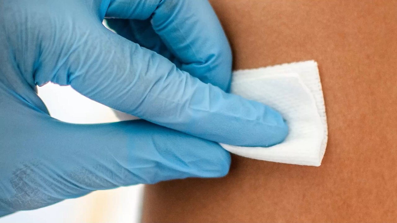 COVID arm: Study finds vaccine side effect to be harmless and temporary