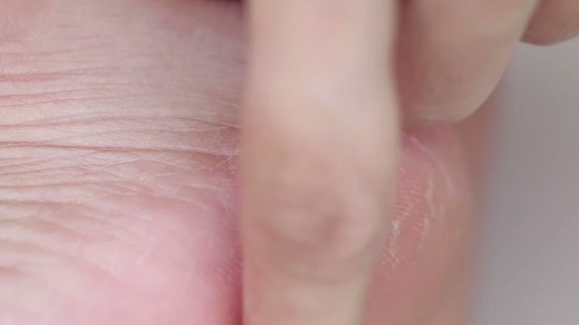 This is how to get rid of cracked heels