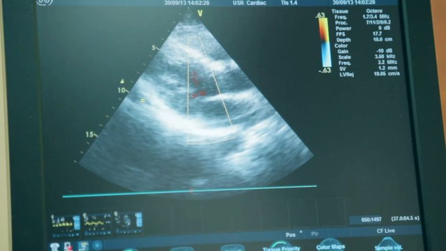 Texas abortion ban: US judge puts temporary halt on 'unlawful' law