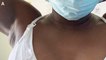 Mother produces breast milk from armpit two days after childbirth