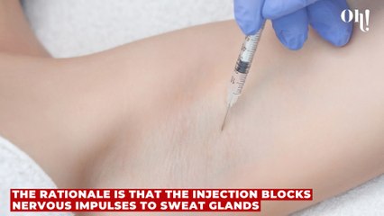 What is armpit botoxing, the new trend making waves among celebs