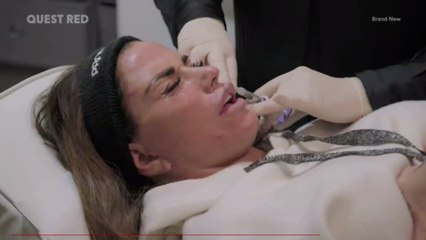 Moderna's COVID-19 jab can cause swelling to people with dermal fillers