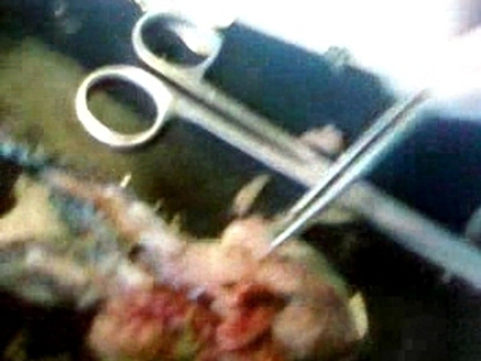 dissection