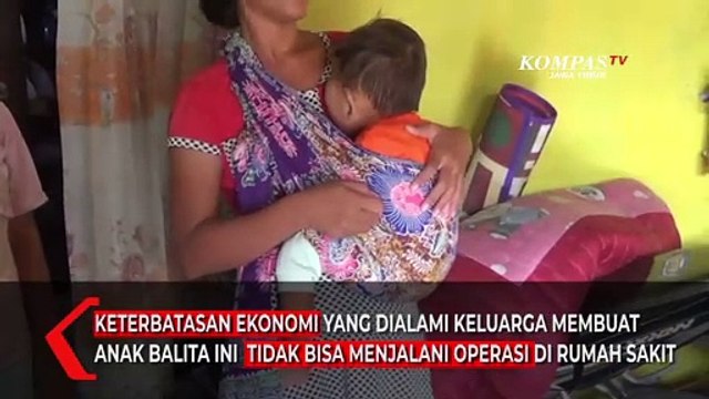 Anak Balita Keluarga Miskin Terkena Kanker Mata