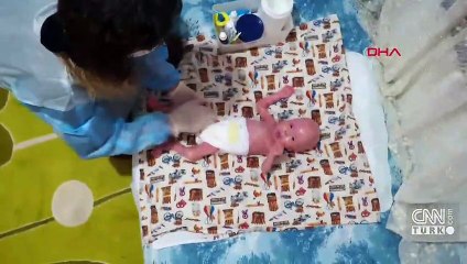 Hastalığı 300 milyonda bir görülüyor