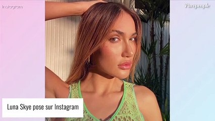 Luna Skye victime de "plusieurs pathologies" après avoir frôlé la mort : les séquelles de son calvaire