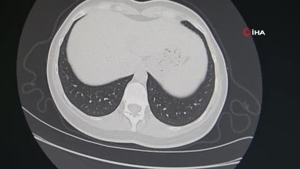 Sigarayı bırak, hayatı bırakma