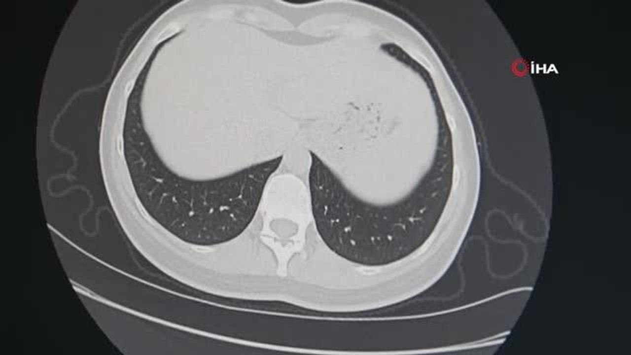 Sigarayı bırak, hayatı bırakma