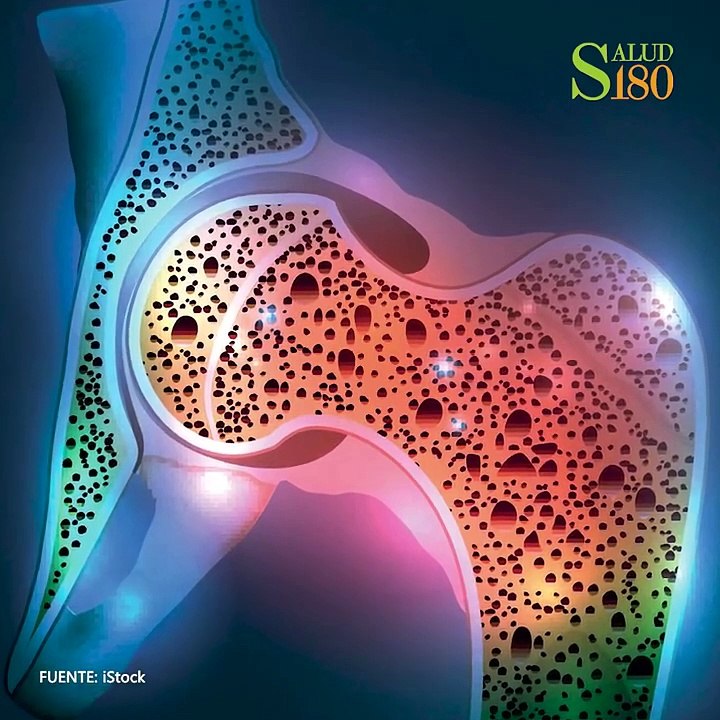 7 Alimentos que podrían pulverizar tus huesos | Salud180