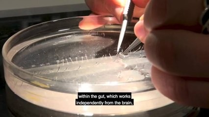 Cracking the Colon Code 2: Unlock Hidden Secrets 🔍