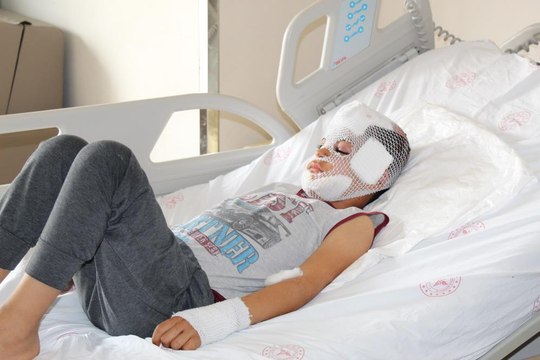 Sokak köpeklerinin saldırısına uğrayan çocuk konuştu