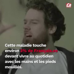 CAM Pourquoi certaines personnes transpirent beaucoup ?