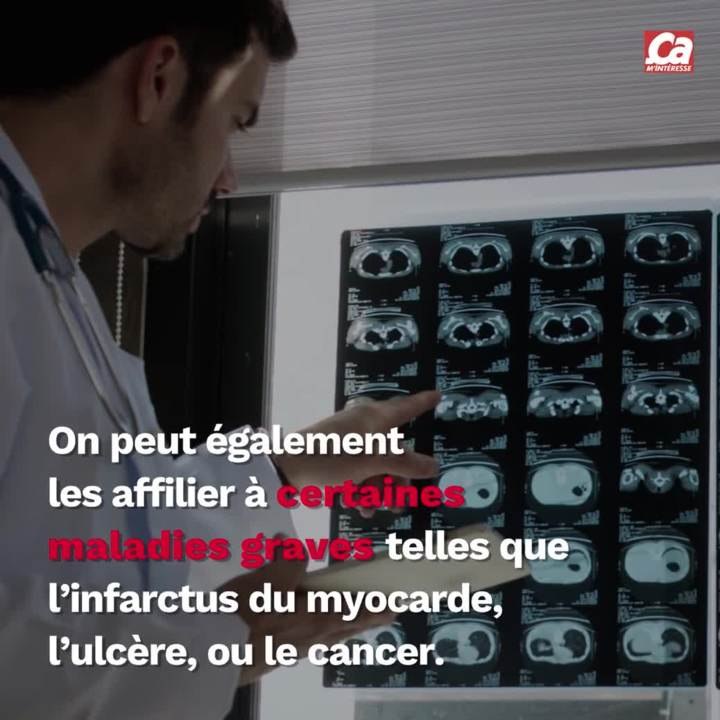 CAM Pourquoi on rote ?