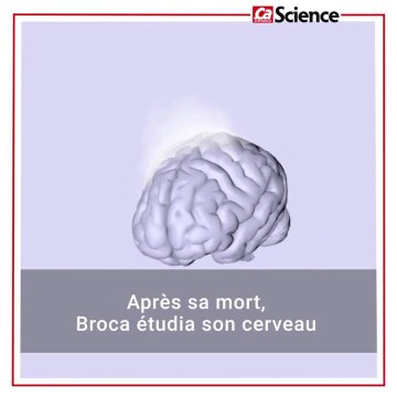 GOT episode 3 De quelle maladie souffre Hodor ?