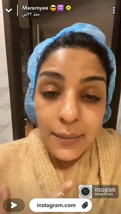 مرام البلوشي بملامح مختلفة بعد التجميل