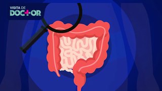 ¿Qué es el cáncer de colon y por qué aparece? | Salud180