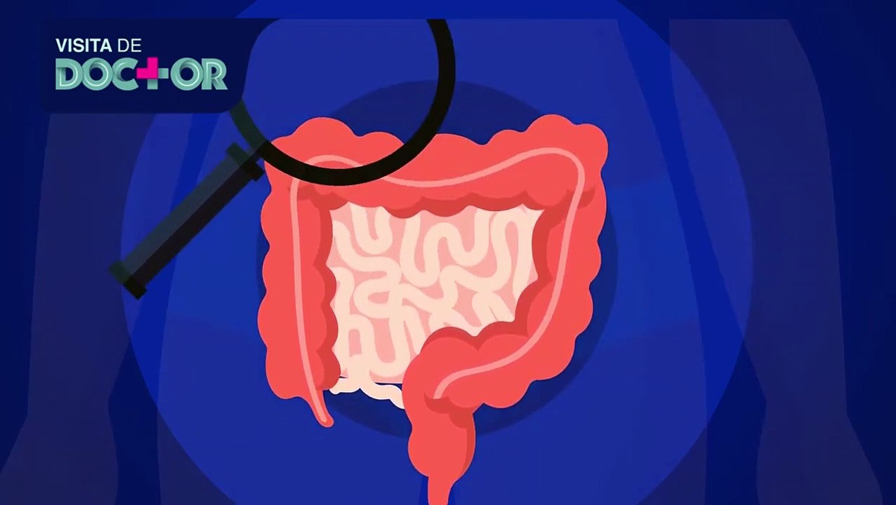 ¿Qué es el cáncer de colon y por qué aparece? | Salud180