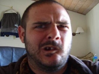 Real Ugly Tootless Guy Going Nuts