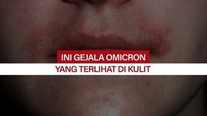 Ini Gejala Omicron yang Terlihat di Kulit