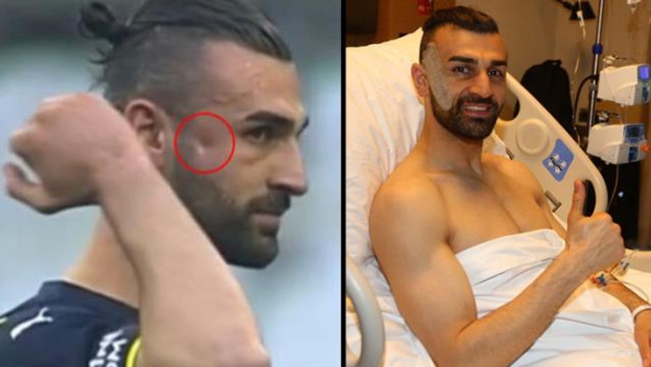 Elmacık kemiğine darbe alan Fenerbahçe'nin forv...