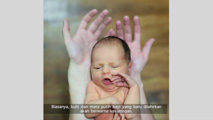 Demam kuning merbahaya atau tidak? - Tips EBU