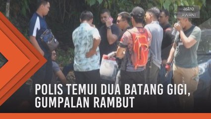 Polis temui dua batang gigi, gumpalan rambut