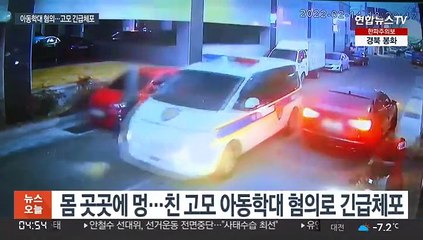 숨진 5살 아이 몸 곳곳에 멍…학대 의심 고모 긴급체포